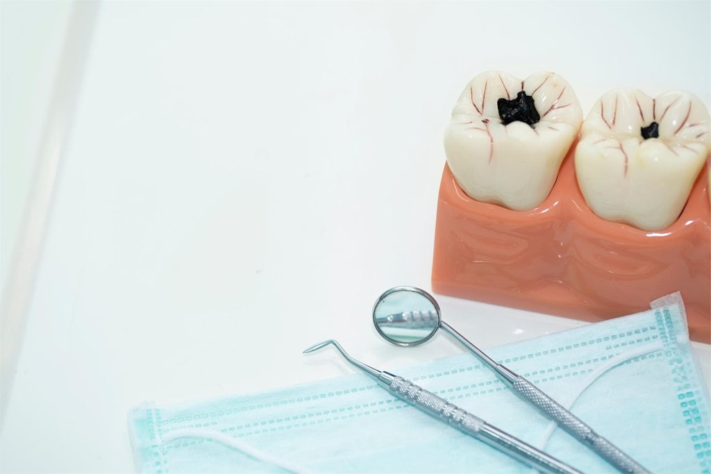 ¿En qué consiste el tratamiento de endodoncia?