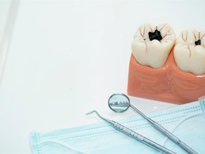 ¿En qué consiste el tratamiento de endodoncia?