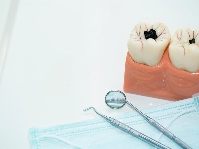 ¿En qué consiste el tratamiento de endodoncia?
