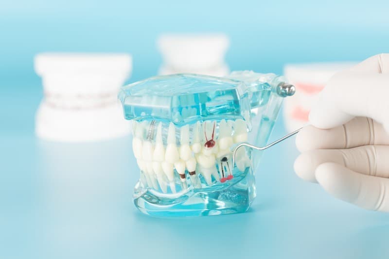Endodoncias en Santiago