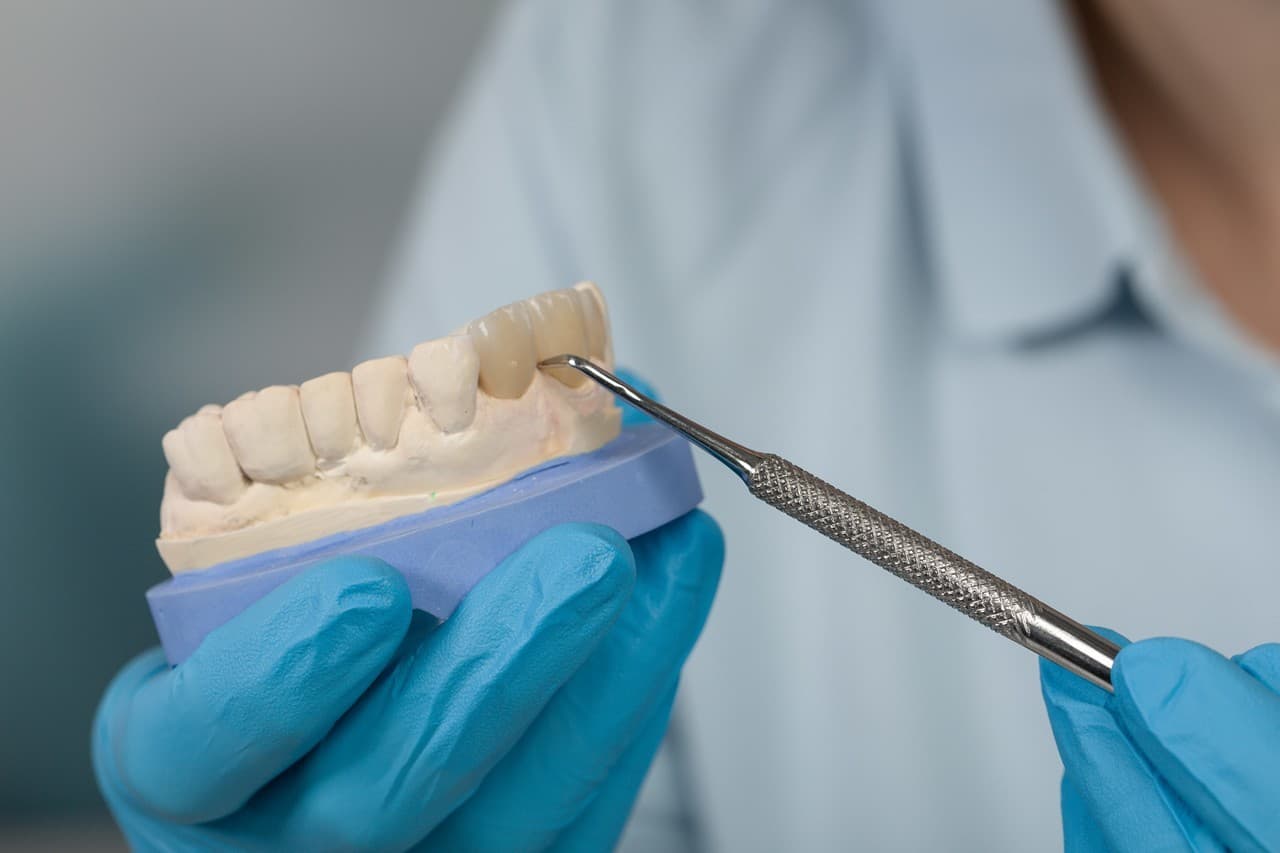 Prótesis dentales fijas en Santiago de Compostela