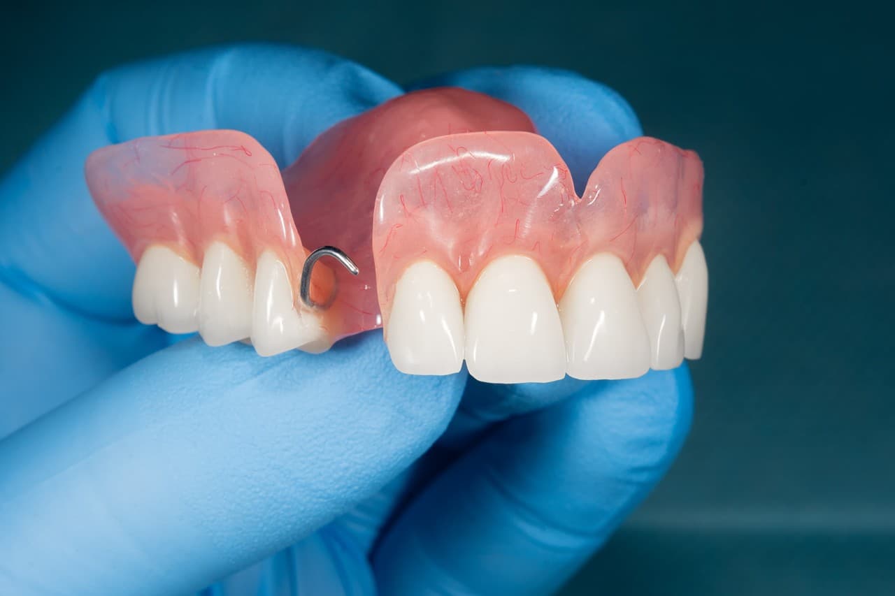 Prótesis dentales removibles en Santiago de Compostela